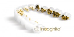 Incognito-II