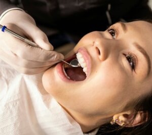 acid reflux and enamel erosion