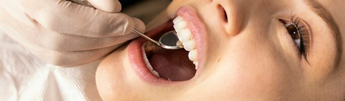 acid reflux and enamel erosion